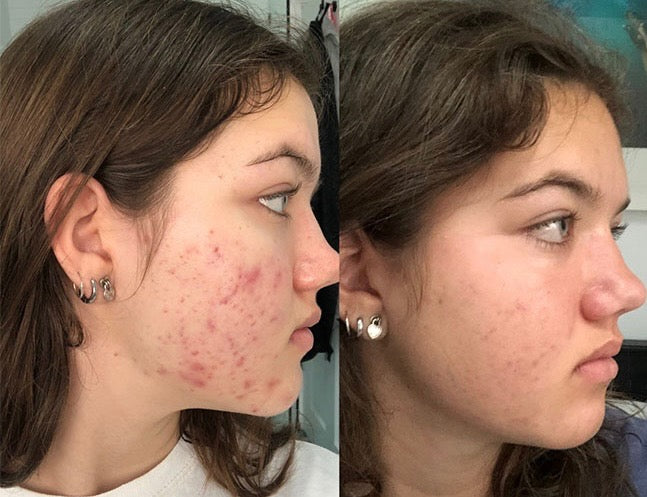 LuminaSkin Brightening & Spot Correcting Primer